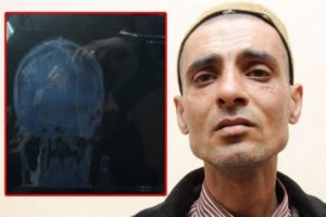 Kafasında iğnelerle yaşıyor