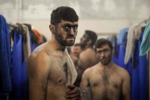Hayatları 'mutlak karanlık'ta ge&ccedil;iyor
