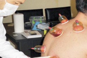 İlk&ouml;ğretimde 'hacamat' skandalı