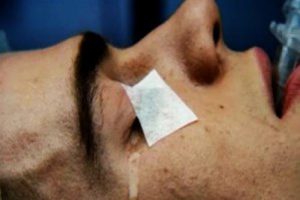 Ameliyatta uyanan gencin dehşet anları