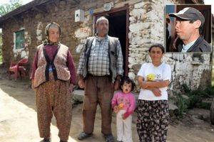 4. y&uuml;z nakli ameliyatının ardından &ccedil;ıkan dram