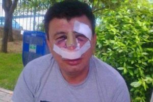 &Ouml;ğretmene feci dayak