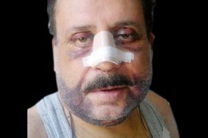 G&ouml;khan G&uuml;ney'e ne oldu?