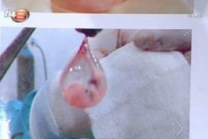 G&ouml;k&ccedil;ek canlı yayında cenin fotoğrafları g&ouml;sterdi