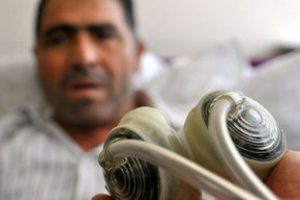 T&uuml;rkiye'nin ikinci kalpsiz hastası!