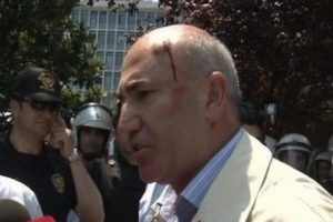 CHP'li vekilin kafası yarıldı