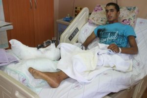 Hastaneye kopan bacağını elinde taşıyarak geldi