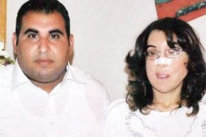 Y&uuml;z nakli beklerken aşık oldu