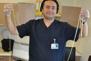 Bağırsağından dev solucan &ccedil;ıktı
