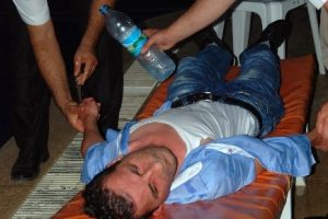 Y&uuml;z nakli hastası Uğur acar korkuttu