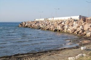 13 yaşında yaşam m&uuml;cadelesi veriyor