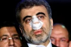 Bakan yumruklayan &ouml;ğretmen Bakan'dan iş istedi