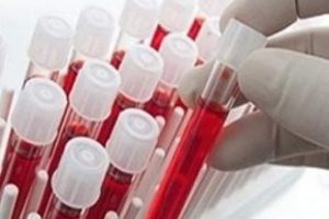Korkutan ş&uuml;phe! 2 bin 400 kişiden kan &ouml;rneği alındı