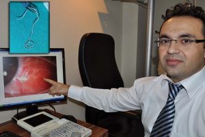 G&ouml;z&uuml;nden 10 cm'lik parazit &ccedil;ıktı