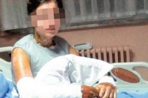 &Uuml;niversiteliye 'Taliban' usul&uuml; asitli saldırı