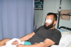 Yaralanan 9 Suriyeli'den 1'i hayatını kaybetti