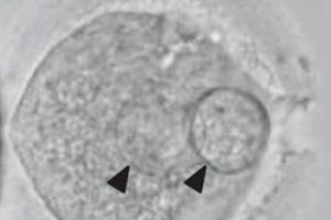 2 kadın 1 erkeğin DNA'sını i&ccedil;eriyor