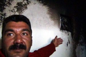 Yangında t&uuml;yler &uuml;rperten ayrıntı