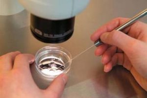 T&uuml;p bebek tedavisinde sevindiren haber