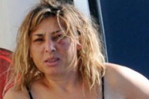 Dayak yemekten akıl sağlığını kaybetti