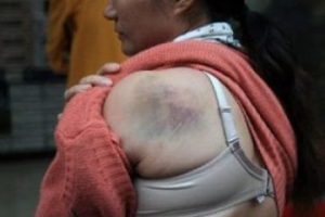 Hamile kadına dayak