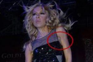 Hadise diyetisyeniyle kavga etti