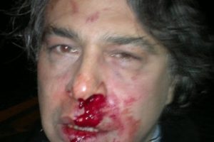 Barbaros Şansal Taksim'de saldırıya uğradı