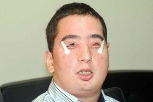 Yeni y&uuml;z&uuml;ne adım adım yaklaşıyor