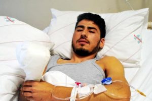 Kopan parmakları yerine dikildi
