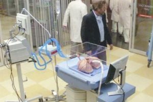 Akciğer naklinde yeni y&ouml;ntem