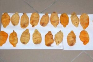 Midesinden 800 gram kokain &ccedil;ıktı