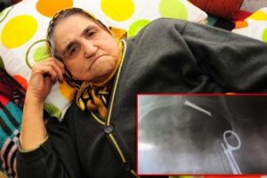 11 yıl v&uuml;cudunda makasla yaşadı