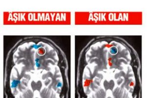 ABD'li psikologlar aşık beyinle aşık olmayan beyni g&ouml;r&uuml;nt&uuml;lemeyi başardı!