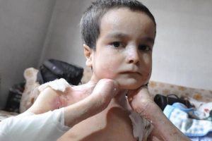 Minik &Ouml;mer'in sessiz &ccedil;ığlığı