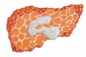 Hepatit B yaşam tarzını değiştiriyor
