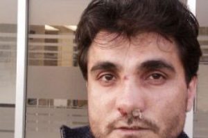 Albay baba polis korumasındaki eşcinsel oğlunu ka&ccedil;ırdı