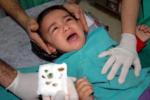 Bunlar minik Ayşenur'un burnundan &ccedil;ıktı