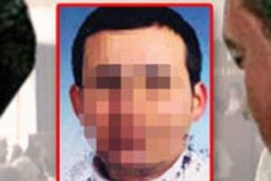 Derisinin altından penis &ccedil;ıktı!