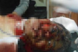 &Uuml;zerinden 3 el bombası &ccedil;ıktı!