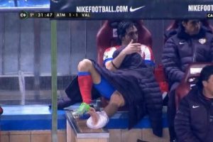 Arda Turan'da sakatlık şoku!