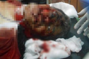 Suriye'de yaralandı T&uuml;rkiye'ye getirildi