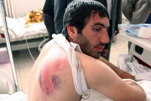 Polise skandal su&ccedil;lama