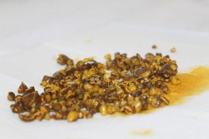 Taş ocağı gibi safra kesesi