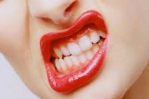 Diş gıcırdatanlar tedaviyi reddediyor