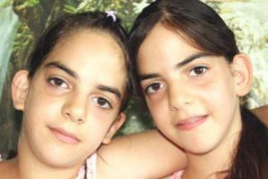 Yapışık ikizler aynı r&uuml;yayı g&ouml;r&uuml;yorlar