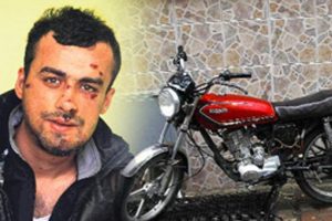 "Kemiklerim kırıldı dilim kesildi"