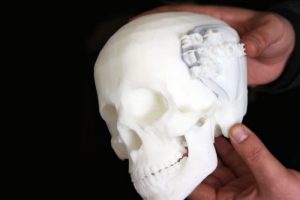 3 boyutlu yazıcıyla t&uuml;m kemikleri &uuml;rettiler
