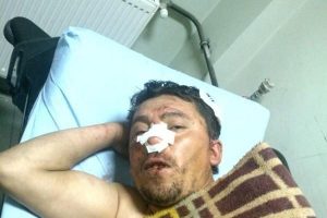Kablo hırsızını, mahalleli &ccedil;ırıl&ccedil;ıplak soyup sopalarla d&ouml;vd&uuml;