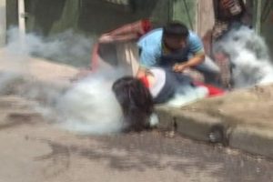 Gaz bombası gen&ccedil; kızı isabet edince...