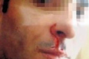 "Karım i&ccedil;ip i&ccedil;ip beni d&ouml;v&uuml;yor"